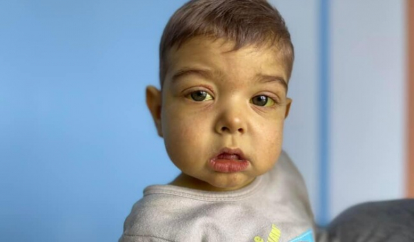 Годовалому ребенку впервые в Украине пересадили печень от посмертного донора - Общество