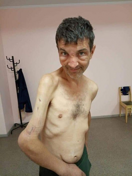 Сестра морпеха Дианова о его состоянии после плена: не хватает 30% веса и 4 сантиметров кости - Общество