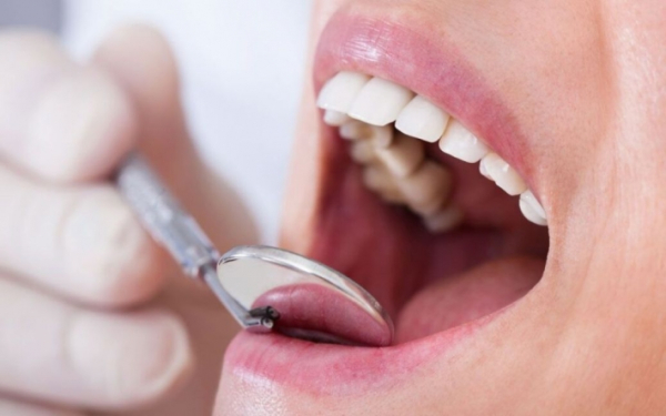  Вы об этом точно не знали: если есть проблемы с кишечником, могут выпадать зубы - Новости Мелитополя 