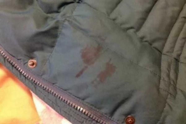 
Как вывести старое пятно на куртке, чтобы не повредить ткань и ее цвет - Новости Мелитополя
