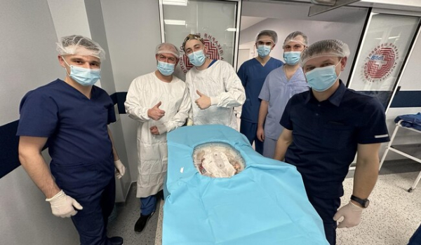 Львовские трансплантологи пересадили печень, задействовав уникальный аппарат - Общество