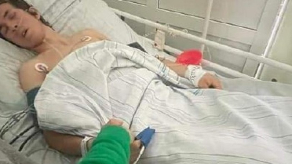 Допоможіть! 18-річний українець, якому відтяло ноги ...
