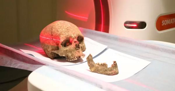 На Тернопольщине отсканировали череп, чтобы выяснить, как выглядел местный житель три тысячи лет назад - Общество